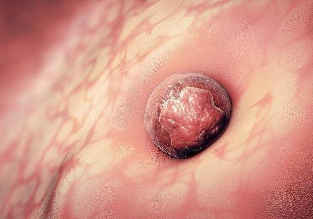 老是觉得自己怀孕了就是测不出来,总觉得自己好像怀孕了但是测没有