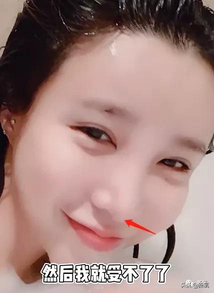 网红整鼻子整出坑,千万网红被坑