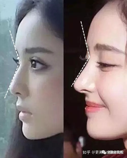 好看的侧脸要符合哪些条件,好看的侧脸的标准