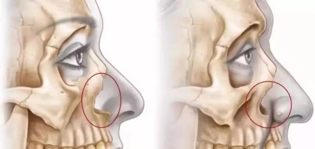 一次解决法令纹的方法,改善法令纹一看就学会