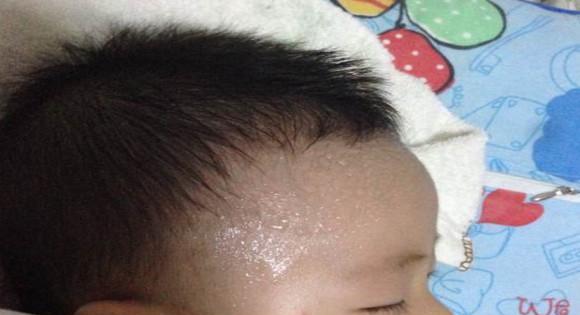 孩子出汗还是发烧,孩子出汗是气虚还是内热