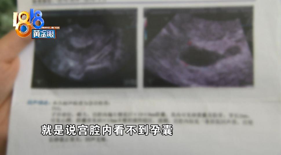 怀孕做过清宫医生能看出吗,做过清宫好不好怀孕