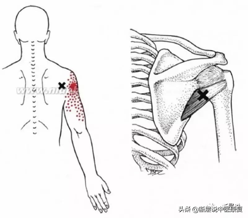 肩膀处抬不起,肩膀抬不起来感觉卡住了
