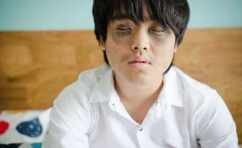 怎么判断黑眼圈跟肾脏有没有关系,眼圈发黑是肾病吗