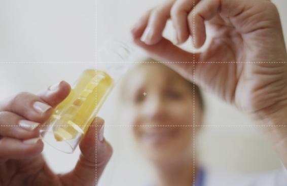 尿液出现这个情况，当心是膀胱癌来袭！日常做好8件小事挡住它