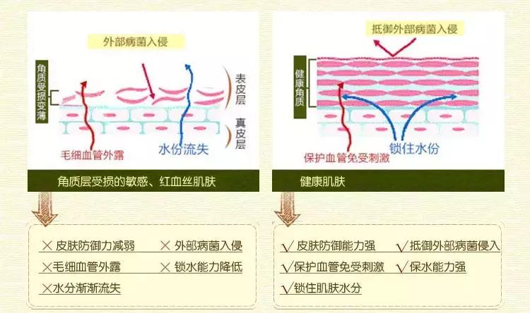 角质层薄容易过敏,角质层薄适合的水