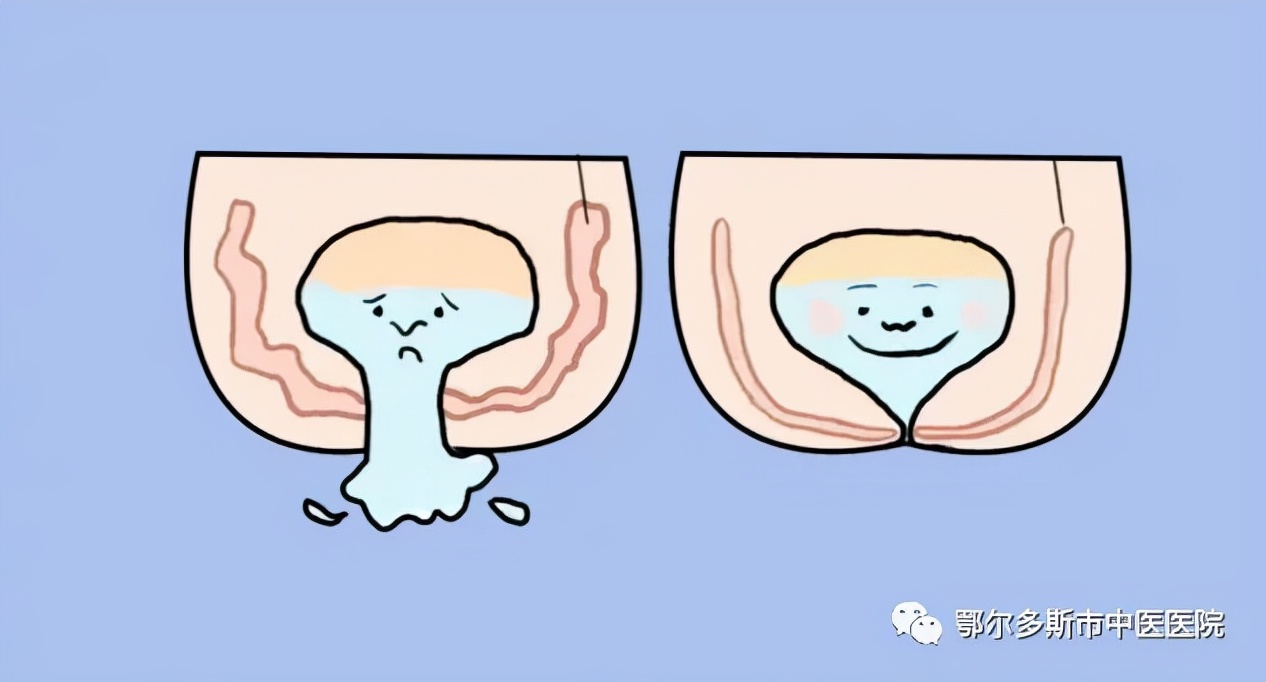 科普|漏尿——发病率很高就诊率却很低