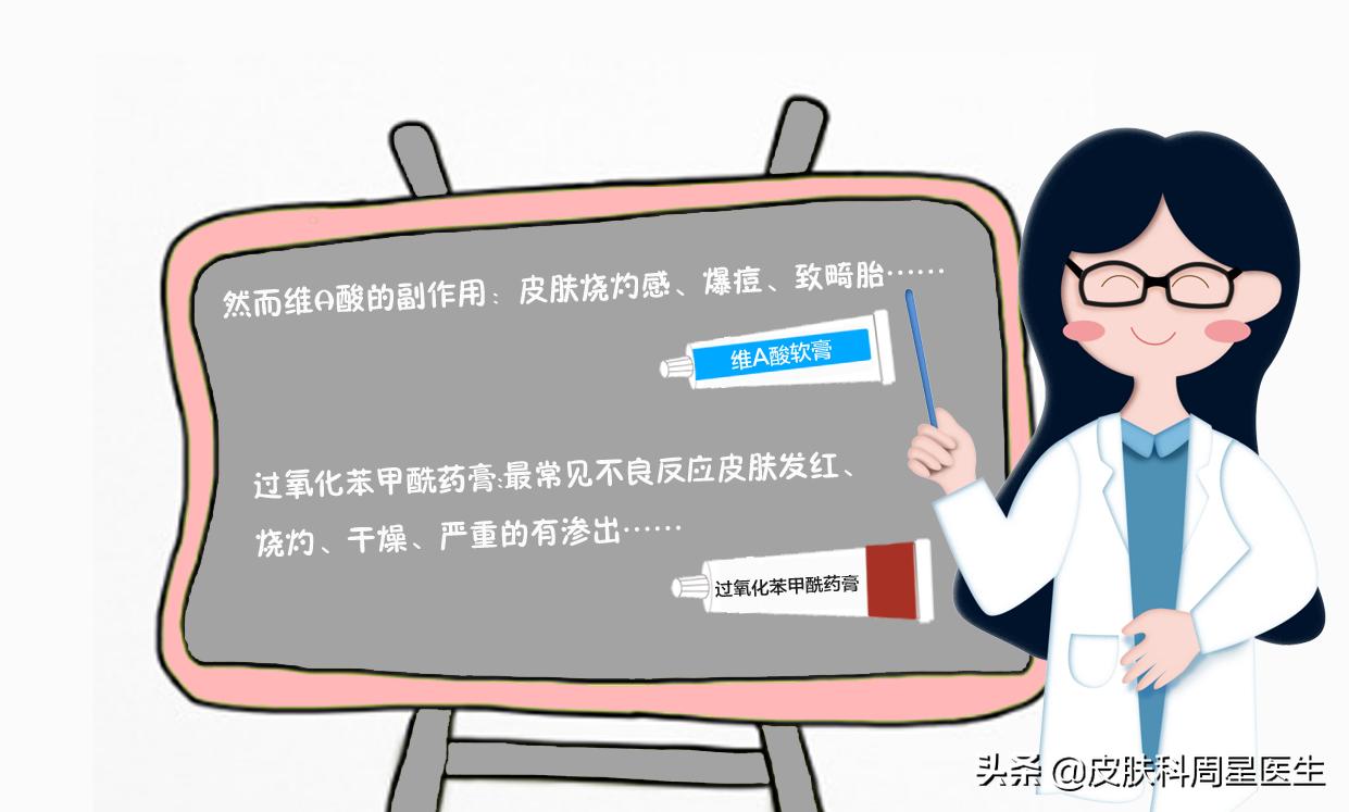 祛痘不要乱用药,祛痘药物不用就起痘