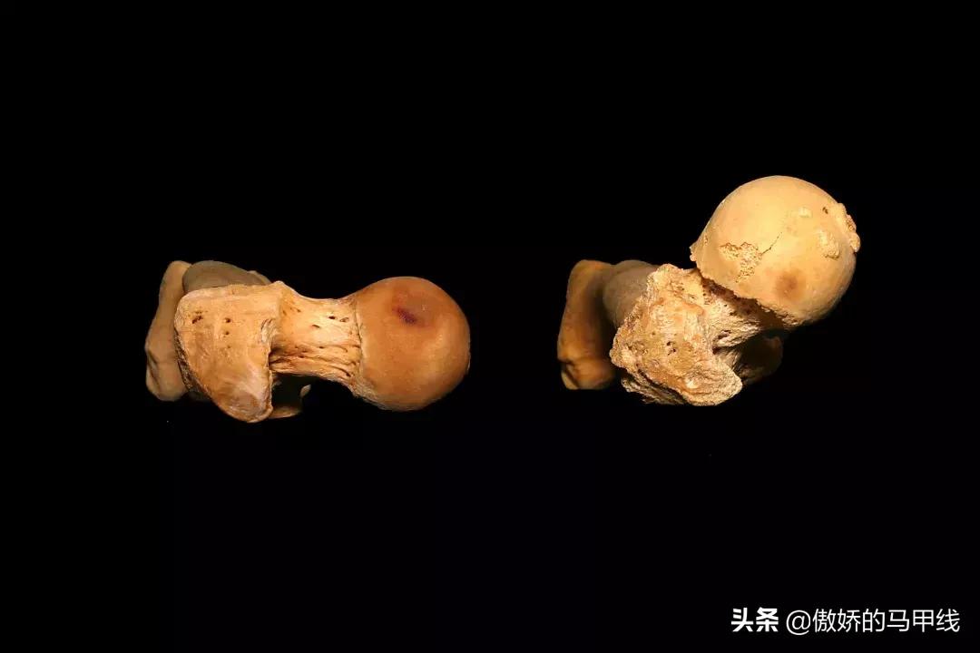 深蹲屁股眨眼如何改善,深蹲屁股眨眼正确吗