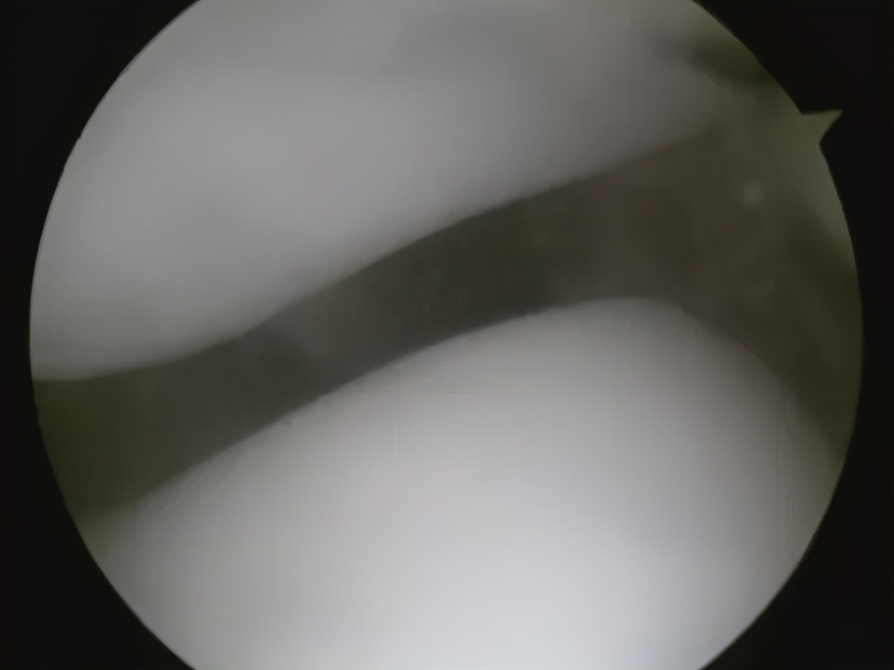 膝盖痛12种疼痛对照表图解,不同部位膝盖疼痛的原因