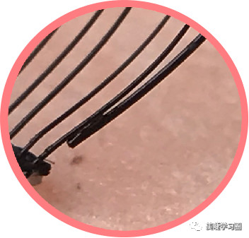 睫毛长扎眼睛该如何处理,睫毛长扎眼睛怎么办小妙招