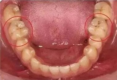 疫情期找不到口腔门诊看牙？这份居家牙病自救指南请查收