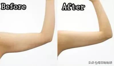 瘦拜拜肉和副乳最快的方法,瘦背和副乳赘肉最有效的方法