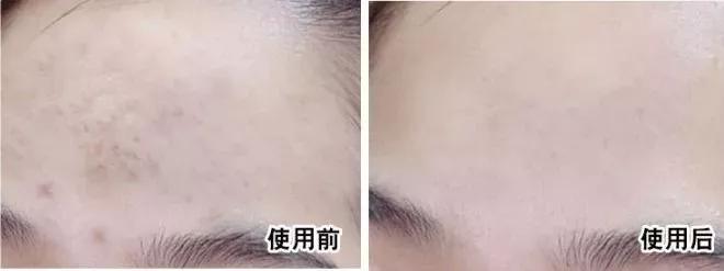 38岁全智贤不愧是国民女神 (年轻时的全智贤满满的胶原蛋白)