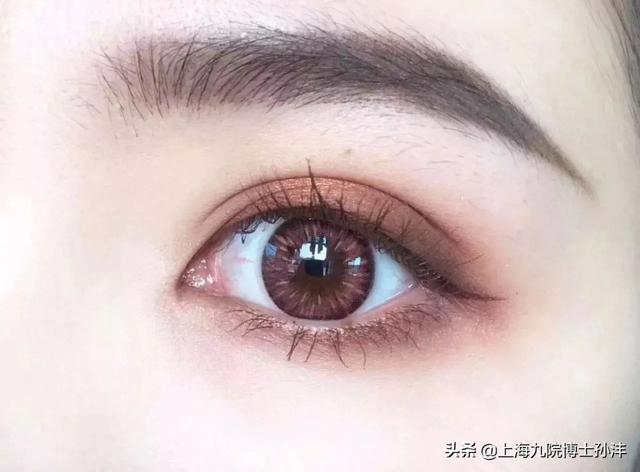 做了双眼皮不好看,做了双眼皮也不好看