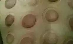 拔罐后为啥有的罐印有的深有的浅,拔罐对人是有好处还是有坏处