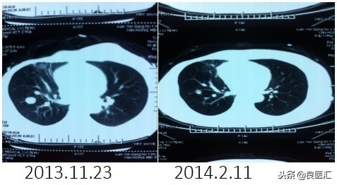 美图秀秀成功案例,美图秀秀实战案例