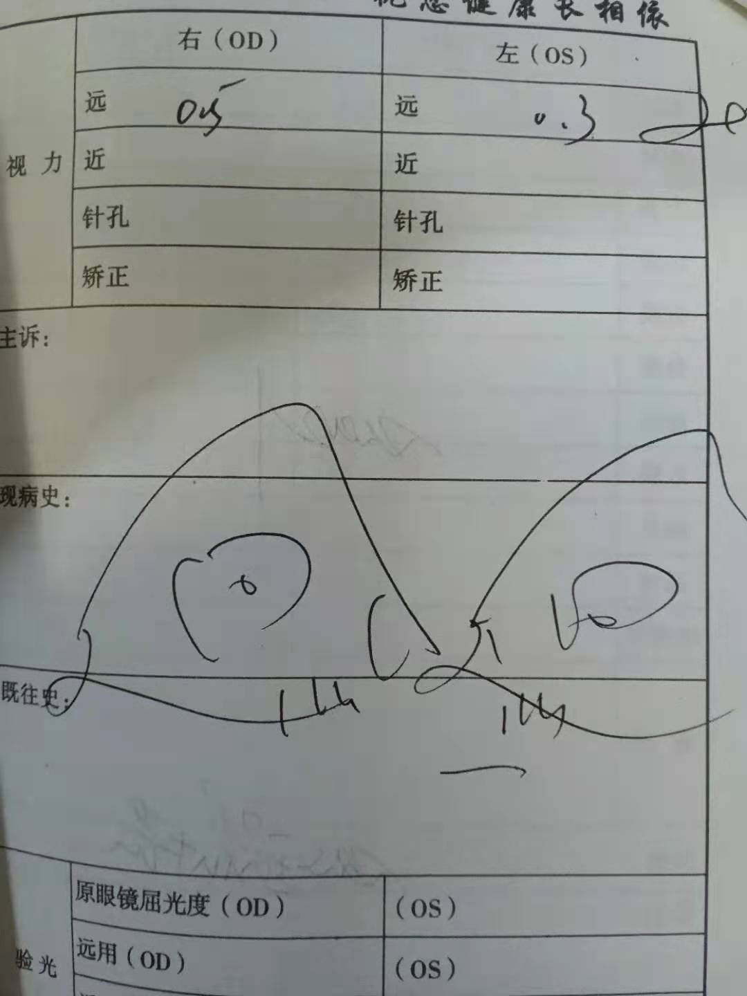 小孩子近视了一定要戴眼镜吗,小孩近视一定要戴眼镜吗