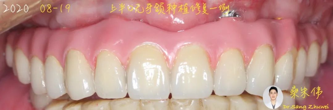 从小白到资深大咖,从小白到大师的蜕变