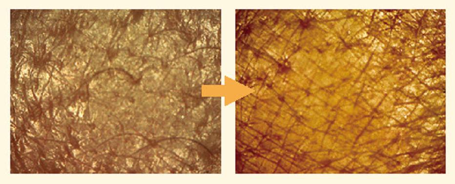 用砂糖可以做的简单皮肤保养，和干燥说再见