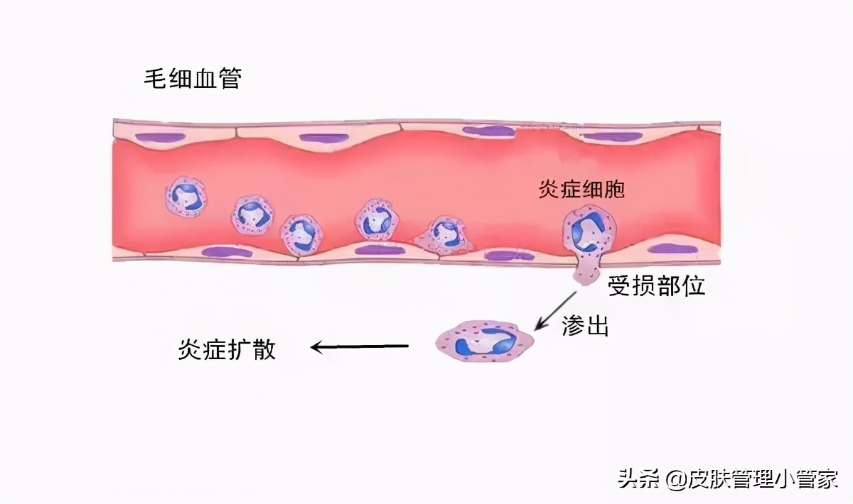 祛斑祛痘皮肤管理,皮肤管理祛痘有效吗
