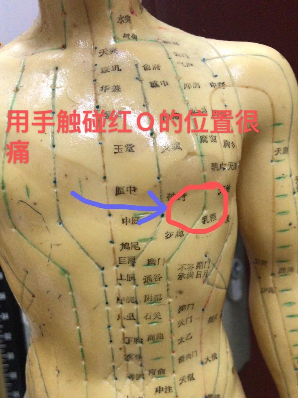 胸痛针灸哪些穴位可以治,董氏针灸治疗岔气胸痛