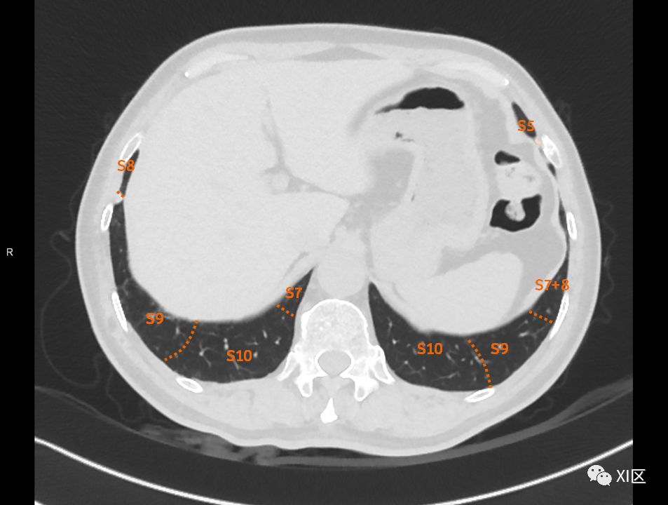 如此详细的肺部影像解剖，有点儿酷