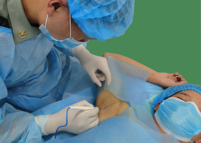 手术治疗狐臭需要住院吗,治疗狐臭手术应挂什么科