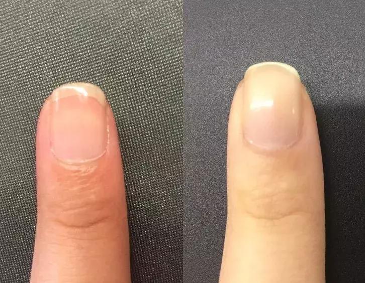 心血来潮做了个美甲,泫雅同款美甲图