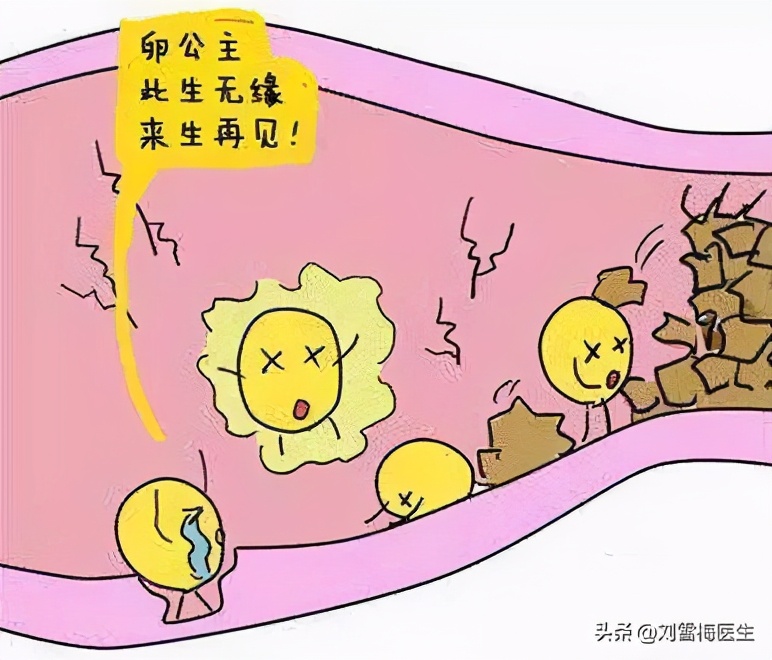 刘雪梅医生科普:流产后一直怀不上,为什么建议你尽快去做造影