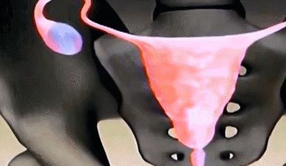 每一个都那么拼命前进，我们还好意思去选择性别吗？