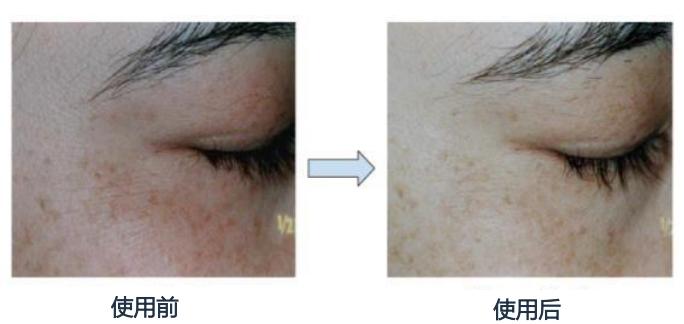 虾青素真的可以抗氧化吗,虾青素抗氧成功