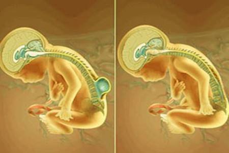 叶酸是如何防止胎儿畸形的,孕妇吃叶酸就可以防止孩子畸形吗