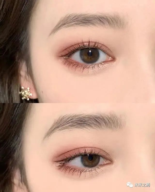 死鱼眼怎么变成炯炯有神的眼神,死鱼眼怎么变成炯炯有神的大眼