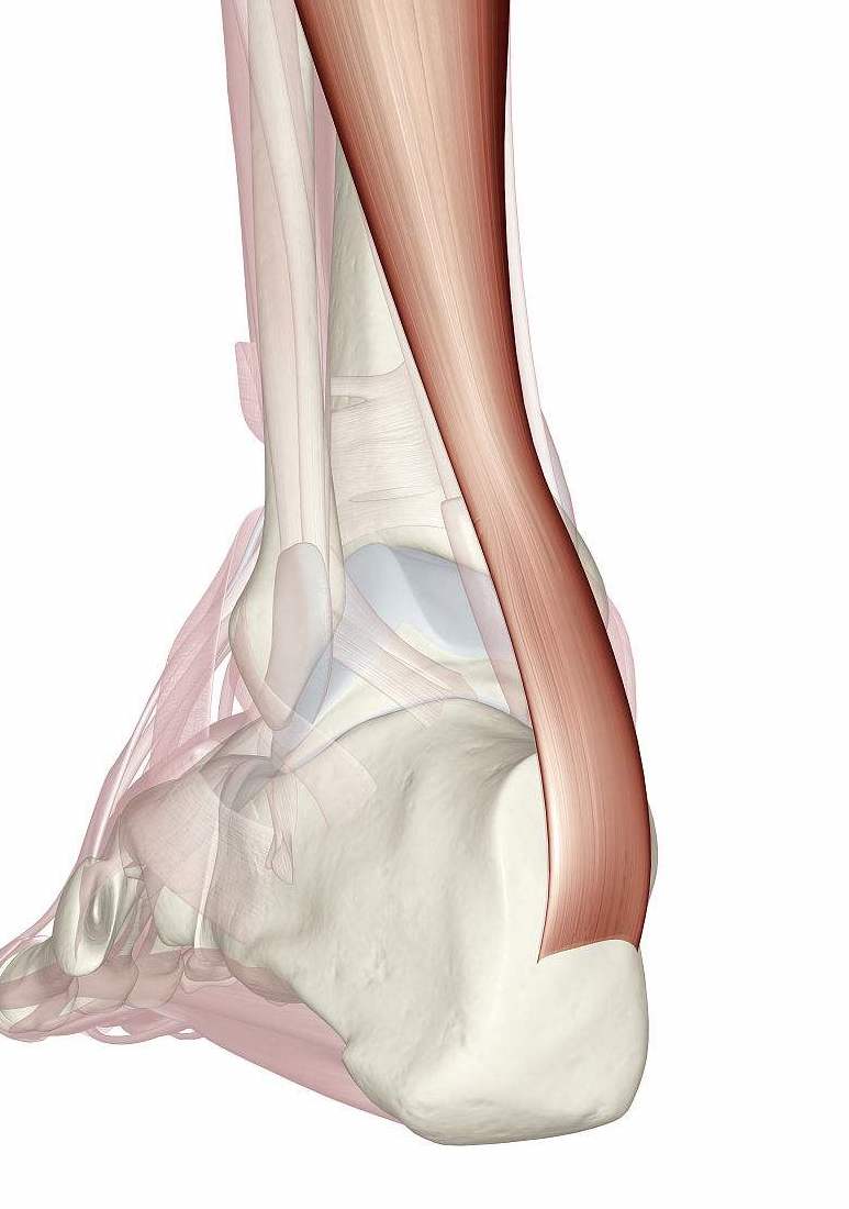 跑步引起的跟腱炎怎么矫正,跑步的隐患