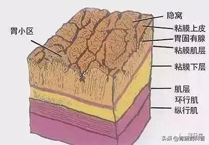 胃癌手术后一年胃镜说胃粘膜隆起,胃镜报告有隆起