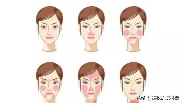 皮肤有血丝有点红怎么修复,红血丝养肤