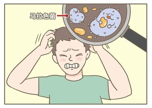 头发油得快是不是病,头发油得快还有头皮屑