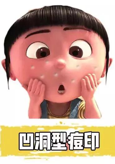 抗痘真实推荐药膏,挤痘痘最有效的药膏