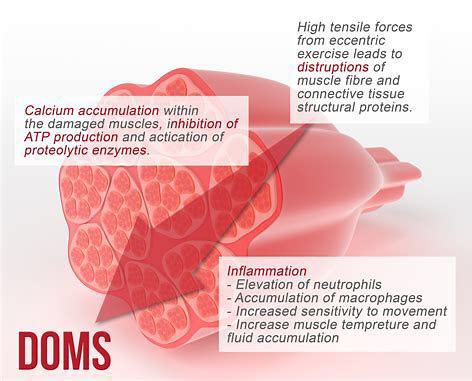 三大要点｜助你摆脱“训练后的恶魔”-延迟性肌肉酸痛