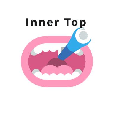 孕期牙疼最佳解决办法,孕期牙疼最好的缓解办法