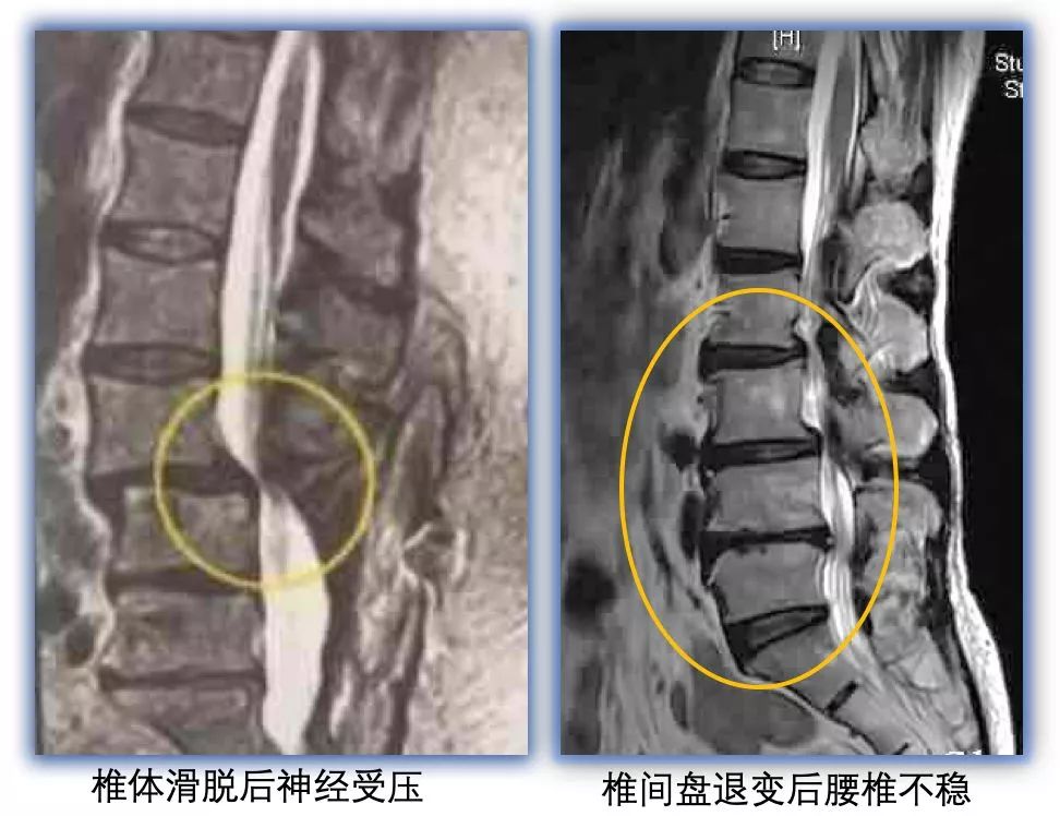腰痛是不是肾不好引起的,腰痛原因弯不直腰