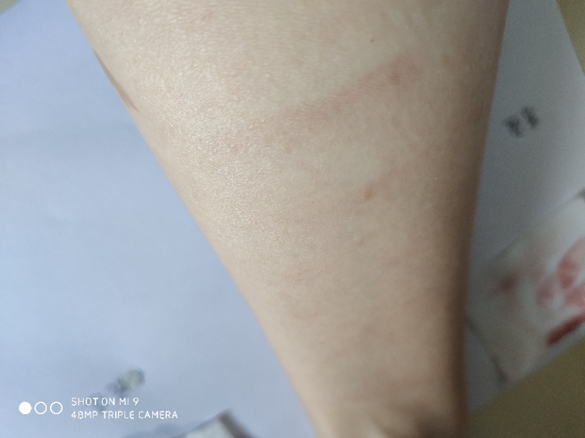 蓓昂斯卸妆水和贝德玛哪个好,西班牙蓓昂斯卸妆水真的假的