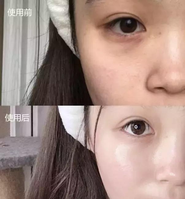 一到晚上皮肤暗沉发黄,一到下午皮肤暗沉