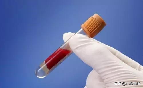 抗病毒特异性免疫应答指什么，乙肝临床停药，需观察DNA与e抗原