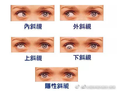 小孩6岁有远视需要治疗吗,儿童眼病的种类和表现症状