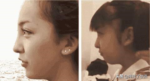 石原里美和佐藤健,石原里美整容之路