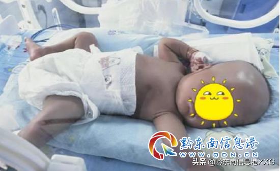 皮包骨变萌娃!丹寨县人民医院成功救治一名重度营养不良患儿