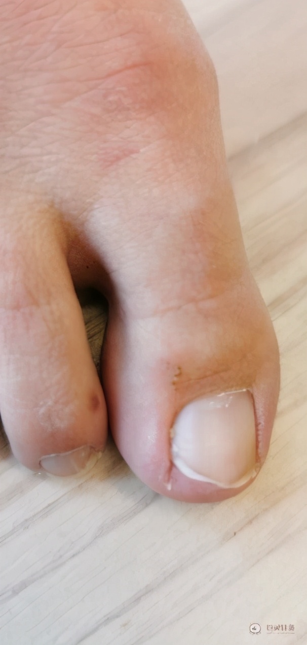 外国人不坐月子不怕得月子病么,欧洲人不坐月子吗