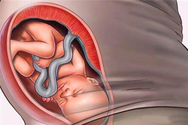 如何判断胎儿入盆啦，这些感觉会提醒你